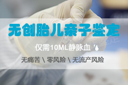 贵阳如何做孕期亲子鉴定